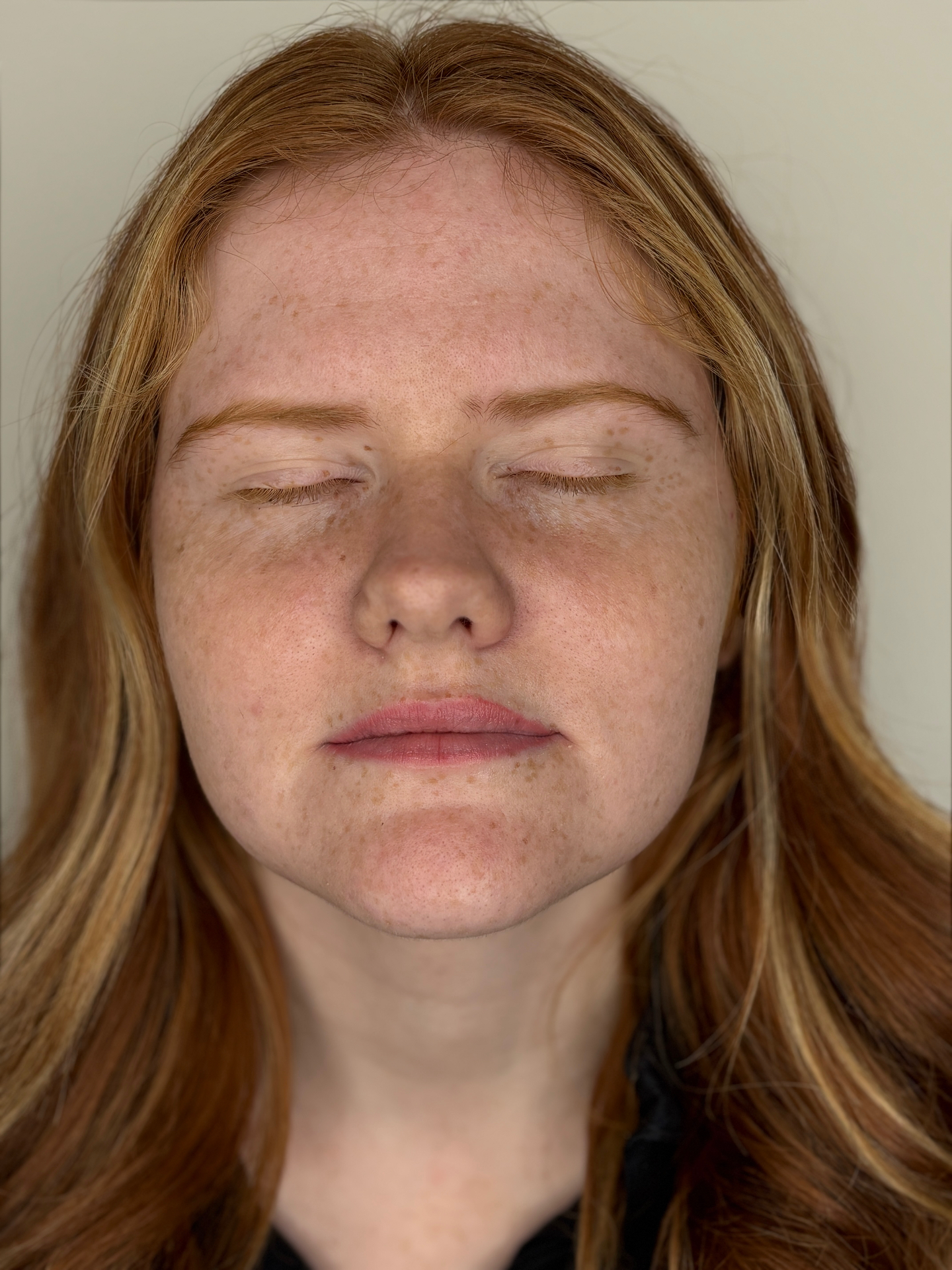 Client lip blush result — front view
